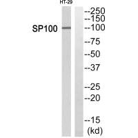 Western blot analysis of extracts from HT29 cells, using SP100 antibody.