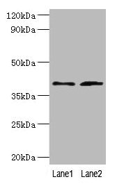 Western blot All lanes: DCN antibody at 2µg/ml Lane 1: Mouse heart tissue Lane 2: HepG2 whole cell lysate Secondary Goat polyclonal to rabbit IgG at 1/10000 dilution Predicted band size: 40, 28, 24, 20, 9 kDa Observed band size: 40 kDa