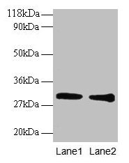 Western blot All lanes: GSTP1 antibody at 2µg/ml Lane 1: EC109 whole cell lysate Lane 2: 293T whole cell lysate Secondary Goat polyclonal to rabbit IgG at 1/15000 dilution Predicted band size: 24 kDa Observed band size: 30 kDa