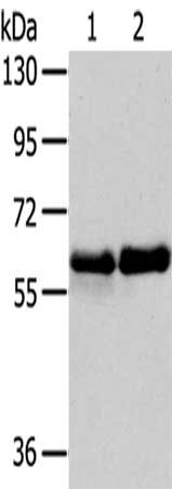 Gel: 6%SDS-PAGE,Lysate: 40 ug,Lane 1-2: Human fetal brain tissue, Mouse brain tissue,Primary antibody: CSB-PA103384(PAK3 Antibody) at dilution 1/200 dilution,Secondary antibody: Goat anti rabbit IgG at 1/8000 dilution,Exposure time: 2 minutes