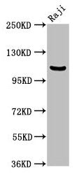 Western Blot Positive WB detected in: Raji whole cell lysate All lanes: NFKB1 antibody at 3.75µg/ml Secondary Goat polyclonal to rabbit IgG at 1/50000 dilution Predicted band size: 106, 86 kDa Observed band size: 106 kDa