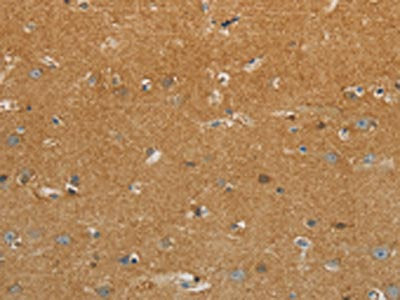 The image on the left is immunohistochemistry of paraffin-embedded Human brain tissue using CSB-PA103567(GJB6 Antibody) at dilution 1/30, on the right is treated with synthetic peptide. (Original magnification: ×200)