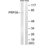 Western blot analysis of extracts from K562 cells, using PRPF39 antibody.