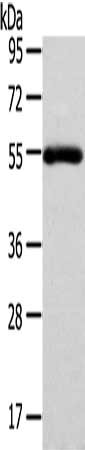 Gel: 8%SDS-PAGE, Lysate: 40 ug, Lane: Human normal liver tissue, Primary antibody: CSB-PA104252(FOXC1 Antibody) at dilution 1/400 dilution, Secondary antibody: Goat anti rabbit IgG at 1/8000 dilution, Exposure time: 3 minutes