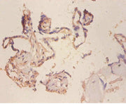 Immunohistochemistry of paraffin-embedded human placenta tissue using CSB-PA10439A0Rb at dilution of 1:100