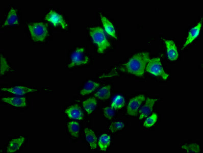 Immunofluorescence staining of SH-SY5Y cells with CSB-PA10468A0Rb at 1:50, counter-stained with DAPI. The cells were fixed in 4% formaldehyde, permeabilized using 0.2% Triton X-100 and blocked in 10% normal Goat Serum. The cells were then incubate...