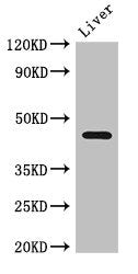 Western Blot Positive WB detected in: Mouse liver tissue All lanes: NGFR antibody at 2.7ug/ml Secondary Goat polyclonal to rabbit IgG at 1/50000 dilution Predicted band size: 46, 36 kDa Observed band size: 46 kDa