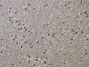 The image on the left is immunohistochemistry of paraffin-embedded Human brain tissue using CSB-PA104816(HSPA9 Antibody) at dilution 1/50, on the right is treated with fusion protein. (Original magnification: ×200)