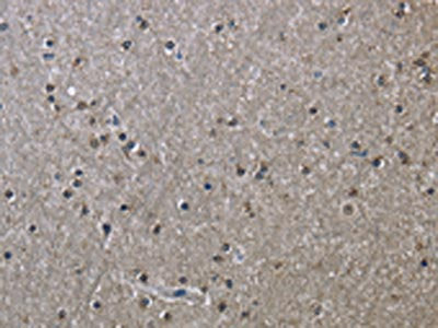 The image on the left is immunohistochemistry of paraffin-embedded Human brain tissue using CSB-PA104816(HSPA9 Antibody) at dilution 1/50, on the right is treated with fusion protein. (Original magnification: ×200)