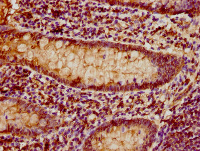 IHC image of CSB-PA10484A0Rb diluted at 1:80 and staining in paraffin-embedded human appendix tissue performed on a Leica BondTM system. After dewaxing and hydration, antigen retrieval was mediated by high pressure in a citrate buffer (pH 6.0). Se...
