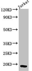 Western Blot Positive WB detected in: Jurkat whole cell lysate All lanes: CD247 antibody at 3µg/ml Secondary Goat polyclonal to rabbit IgG at 1/50000 dilution Predicted band size: 19 kDa Observed band size: 19 kDa