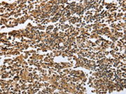 The image on the left is immunohistochemistry of paraffin-embedded Human tonsil tissue using CSB-PA105007(ECE1 Antibody) at dilution 1/60, on the right is treated with fusion protein. (Original magnification: ×200)