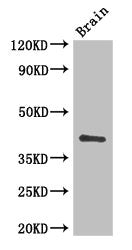 Western Blot Positive WB detected in: Mouse brain tissue All lanes: CD34 antibody at 3ug/ml Secondary Goat polyclonal to rabbit IgG at 1/50000 dilution Predicted band size: 41, 36 kDa Observed band size: 41 kDa