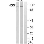 Western blot analysis of extracts from 293 cells and JK cells, using HGS antibody.