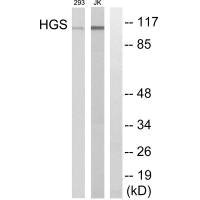 Western blot analysis of extracts from 293 cells and JK cells, using HGS antibody.