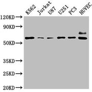 Western Blot Positive WB detected in: K562 whole cell lysate, Jurkat whole cell lysate, U87 whole cell lysate, U251 whole cell lysate, PC3 whole cell lysate, HUVEC whole cell lysate All lanes: NT5E antibody at 1:2000 Secondary Goat polyclonal to r...