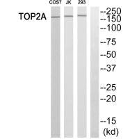Western blot analysis of extracts from HT-29 cells, using TOP2A antibody.