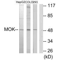 Western blot analysis of extracts from HepG2 cells, COLO205 cells and 293 cells, using MOK antibody.