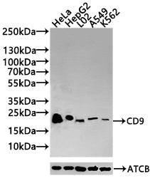 Western Blot Positive WB detected in: Hela whole cell lysate(30µg), HepG2 whole cell lysate(30µg), L02 whole cell lysate(30µg), A549 whole cell lysate(30µg), K562 whole cell lysate(30µg) All lanes: CD9 antibody at 1:1000 Secondary Goat polyclonal...