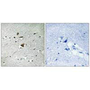 Immunohistochemistry analysis of paraffin-embedded human brain tissue using APC1 antibody.