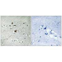 Immunohistochemistry analysis of paraffin-embedded human brain tissue using APC1 antibody.