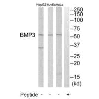 Western blot analysis of extracts from HeLa cells, HuvEc cells and HepG2 cells, using BMP3 antibody.