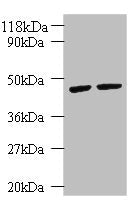 Western blot All lanes: KRT18 antibody at 2µg/ml Lane 1: K562 whole cell lysate Lane 2: HepG2 whole cell lysate Secondary Goat polyclonal to rabbit IgG at 1/10000 dilution Predicted band size: 49 kDa Observed band size: 49 kDa