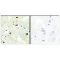 Immunohistochemistry analysis of paraffin-embedded human brain tissue using EPHB1/2/3 antibody.