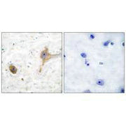 Immunohistochemical analysis of paraffin-embedded human brain tissue using GABA B Receptor antibody.