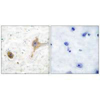 Immunohistochemical analysis of paraffin-embedded human brain tissue using GABA B Receptor antibody.