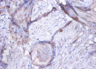 Immunohistochemistry of paraffin-embedded human prostate tissue using CSB-PA10644A0Rb at dilution of 1:100
