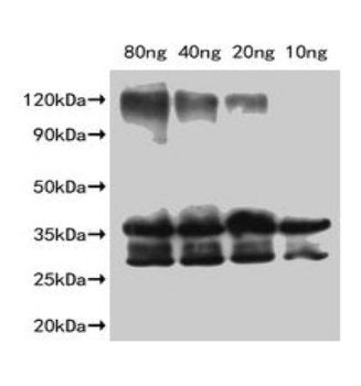 Western Blot Positive WB detected in Recombinant protein All lanes: Slfn9 antibody at 1:2000 Secondary Goat polyclonal to rabbit IgG at 1/50000 dilution Predicted band size: 36.2 kDa Observed band size: 35 kDa