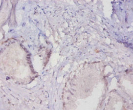 Immunohistochemistry of paraffin-embedded human prostate tissue using CSB-PA10657A0Rb at dilution of 1:20