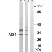Western blot analysis of extracts from Jurkat cells and HeLa cells, using AIG1 antibody.