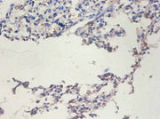 Immunohistochemistry of paraffin-embedded human lung tissue using CSB-PA10669A0Rb at dilution of 1:100