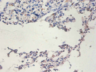 Immunohistochemistry of paraffin-embedded human lung tissue using CSB-PA10669A0Rb at dilution of 1:100