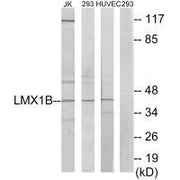 Western blot analysis of extracts from Jurkat cells, 293 cells and HUVEC cells, using LMX1B antibody.