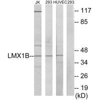 Western blot analysis of extracts from Jurkat cells, 293 cells and HUVEC cells, using LMX1B antibody.