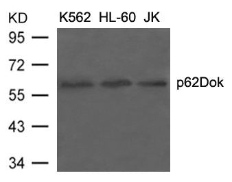 Western blot analysis of extracts from K562, HL-60 and JK cells using p62Dok(Ab-398) Antibody.