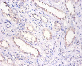 Immunohistochemistry of paraffin-embedded human kidney tissue using CSB-PA10709A0Rb at dilution of 1:100