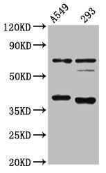 Western Blot Positive WB detected in: A549 whole cell lysate, 293 whole cell lysate All lanes: CTSS antibody at 1:4000 Secondary Goat polyclonal to rabbit IgG at 1/50000 dilution Predicted band size: 38, 32 kDa Observed band size: 38 kDa