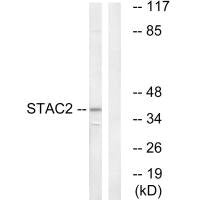 Western blot analysis of extracts from K562 cells, using STAC2 antibody.