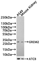 Western blot analysis of Mouse kidney, 293T, Mouse lung, antibody was diluted at 1000. Secondary antibody was diluted at 1:20000