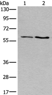 Gel: 8%SDS-PAGE, Lysate: 40 ug, Lane 1-2: Human cerebella tissue and Human cerebrum tissue lysates, Primary antibody: CSB-PA107772(SLC17A8 Antibody) at dilution 1/250, Secondary antibody: Goat anti rabbit IgG at 1/8000 dilution, Exposure time: 10...