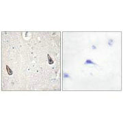 Immunohistochemistry analysis of paraffin-embedded human brain tissue using ADCY5/6 antibody.