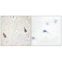 Immunohistochemistry analysis of paraffin-embedded human brain tissue using ADCY5/6 antibody.