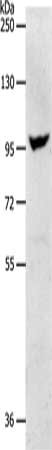Gel: 8%SDS-PAGE, Lysate: 40 ug, Lane: Human fetal brain tissue, Primary antibody: CSB-PA108395(NFATC2 Antibody) at dilution 1/650, Secondary antibody: Goat anti rabbit IgG at 1/8000 dilution, Exposure time: 10 minutes