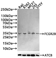 Western blot All lanes: FCGR2B antibody at 2 ug/ml + Mouse liver tissue Secondary Goat polyclonal to rabbit IgG at 1/10000 dilution Predicted band size: 35, 32, 34 kDa Observed band size: 35, 50 kDa