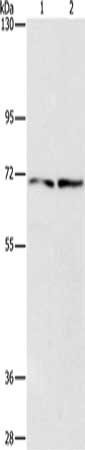 Gel: 8%SDS-PAGE, Lysate: 40 ug, Lane 1-2: HepG2 cells, 293T cells, Primary antibody: CSB-PA108409(IFT74 Antibody) at dilution 1/1400, Secondary antibody: Goat anti rabbit IgG at 1/8000 dilution, Exposure time: 15seconds