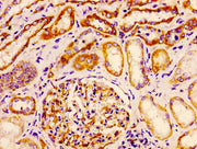 Immunohistochemistry of paraffin-embedded human kidney tissue using CSB-PA10857A0Rb at dilution of 1:100